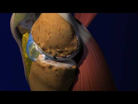 Видео о препарате Синвиск 16мг 2мл шприц №3