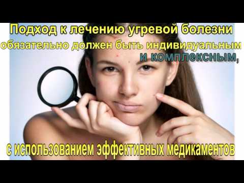 Видео о препарате Изотретиноин Actavis (аналог Акненормин) капсулы 20мг №30